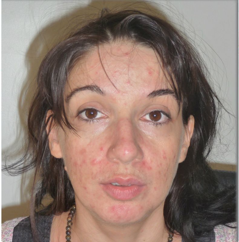 AVANT APRES RELOOKING 13